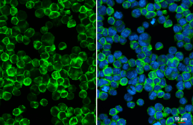 Anti-ESAM antibody [HL5518] used in Immunocytochemistry/ Immunofluorescence (ICC/IF). GTX646181